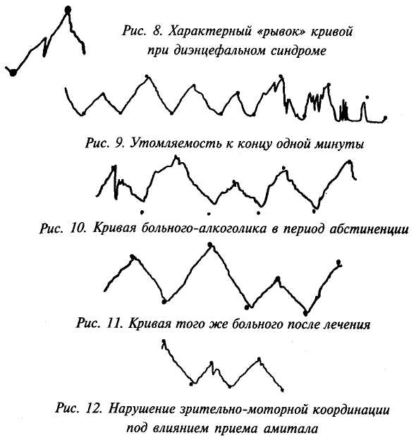 Четырехстопный хорей схема